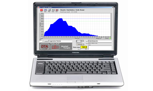 Foto DT1 su PC